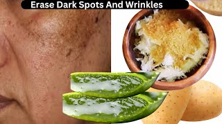 Potato Erases All Dark Spots And Wrinkles On Your Face! Anti-Aging Secrets!