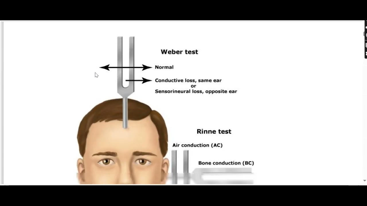 Audiometry And Audiogram Youtube