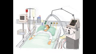 (Ventilator)شرح جهاز التنفس الصناعى