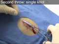 basic laceration repair