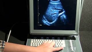 CHISON ECO1 Vet - How To Operate And Use In Animal Echosonography Scanning