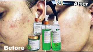 My Skincare Routine ft Truly Beauty | CBD Jelly Skincare Review