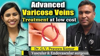 उन्नत वैरिकाज़ नसों का उपचार | Advanced Varicose Veins Treatment at low cost  Dr.G.V. Praveen Kumar