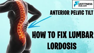 How To Fix Lumbar Lordosis and Anterior Pelvic Tilts - Full Exercise and Stretch Plan!