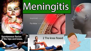 Meningitis in Children - Most Deadly infection for Children