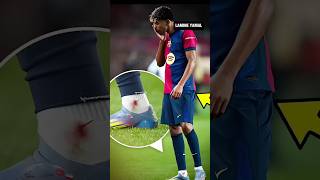 Why Lamine Yamal’s feet bleed every game #shorts #lamineyamal #football #dribbling #pain #football