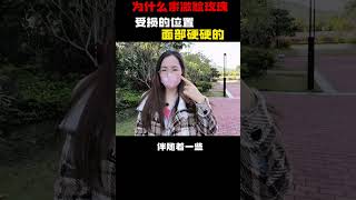 为什么素激脸玫瑰受损的位置面部硬硬的？ 激素脸 敏感肌 大红脸