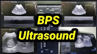 BPS Biophysical Ultrasound