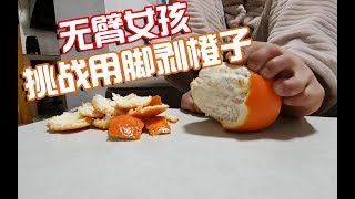 无臂女孩挑战用脚剥橙子，老公在旁边看不下去了，直接上手帮忙