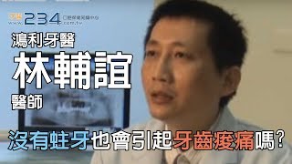 [牙醫234]沒有蛀牙也會引起牙齒痠痛嗎?