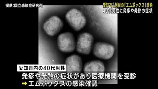 愛知県で2例目の「エムポックス」（サル痘）感染を確認　患者の４０代男性に海外渡航歴なし (23/06/01 21:56)