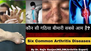 गठिया रोग के 6 सबसे आम प्रकार | Six Most common Arthritis in World