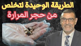 الطريقة الوحيدة لتخلص من حجر المرارة الدكتور محمد الفايد