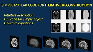 Simple code for iterative image reconstruction (see https://youtu.be/IhETD4nSJec for PYTHON version)