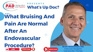 What Bruising And Pain Are Normal After An Endovascular Procedure | Dr. Brett Weichman