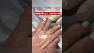 Injecting a neuroma | #Shorts