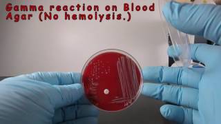 Gamma Reaction on Blood Agar