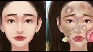 ASMR satisfying face acne treatment animation video (asdasmr07)