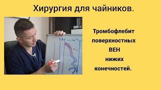 Тромбофлебит поверхностных вен нижних конечностей