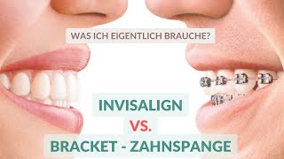 INVISALIGN vs. BRACKET-ZAHNSPANGE | Was ist besser für dich?