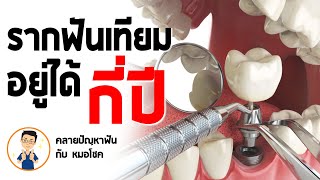 รากฟันเทียม อยู่ได้กี่ปี ? | คลายปัญหาฟัน กับ หมอโชค