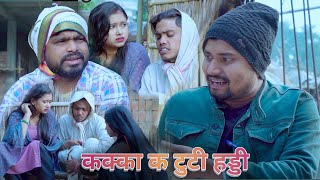 उमेश तोड़ेन कक्का क हड्डी umesh nishad comedy