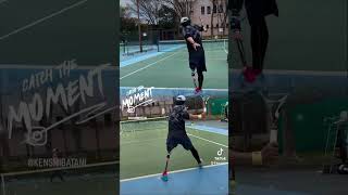 Adaptive tennis in standing position without a wheelchair!!義足を履いて車いすに乗らずに立ってテニスをする立位テニス #義足