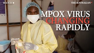 Why scientists are worried about ever changing MPOX virus