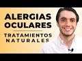 TRATAMIENTOS CASEROS para la ALERGIA OCULAR | Los MEJORES Consejos para el Picor de Ojos