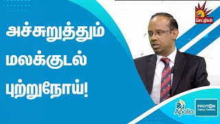 மலக்குடல் புற்றுநோய் வரக்காரணம் இதுதான் | DR.SENTHIL KUMAR | Apollo Proton