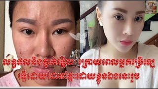 លទ្ធផលនិងភ្ញាក់ផ្អើល! ក្រោយពេលអ្នកប្រើឡេធ្វើដោយដៃនៅផ្ទះដោយខ្លួនឯងនេះរួច , kayi