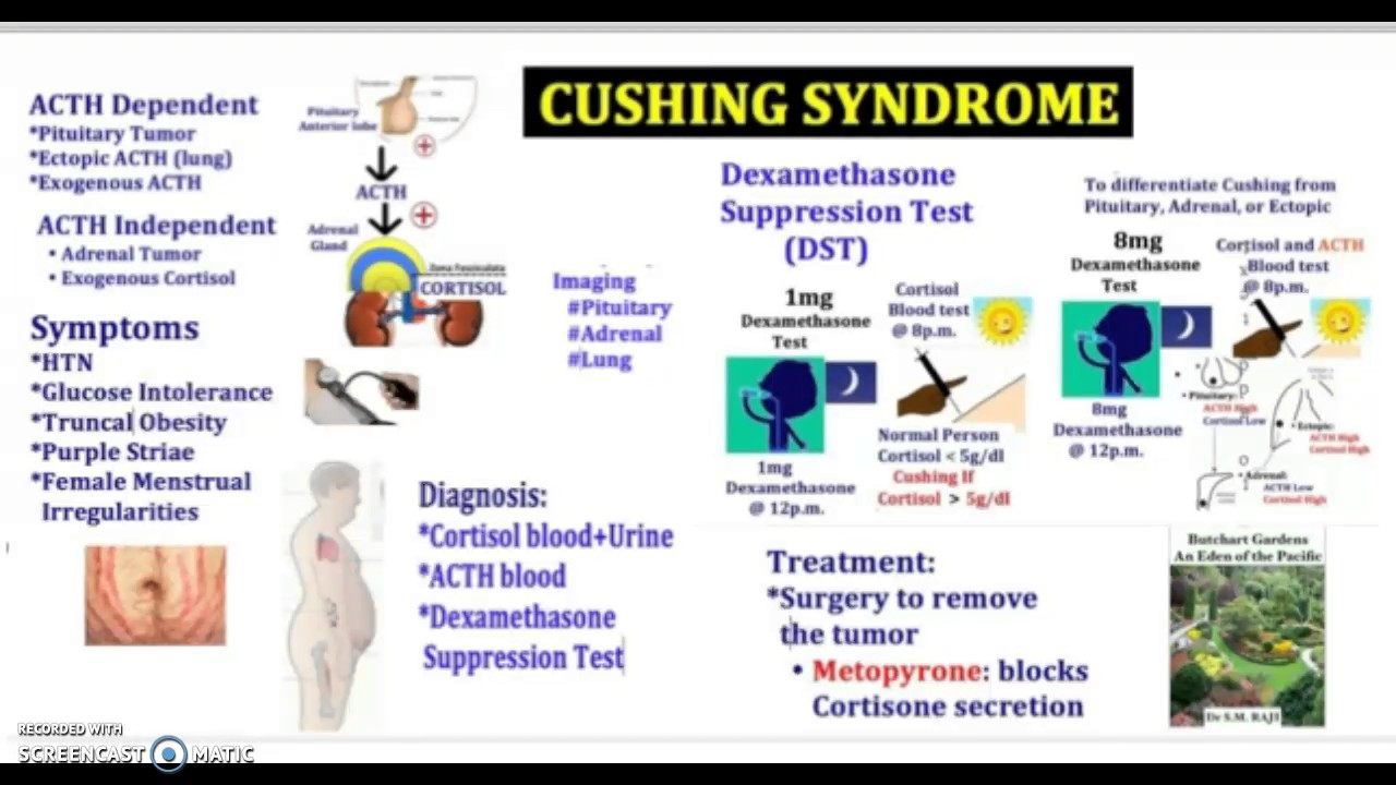 Cushing Syndrome - Causes, Symptoms, Diagnosis, Treatment, Pathology In ...