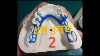 국소의치 (납형성 제작,2) ㆍ139(YG Dental Lab)