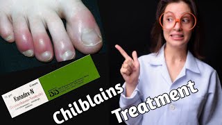 what is Chilblains| chilblains treatment| Doctor farzana