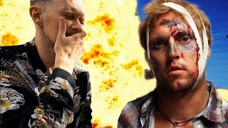 HP'S 5 WORST ACCIDENTS (Dudesons)