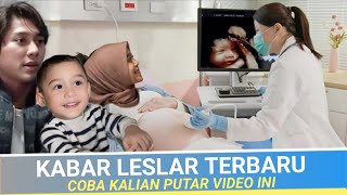 Terbaru !! Semua Jadi Senang, Abang L Salfok Gegara Dokter Perlihatkan Ini, Lesti Kejora Haru,Leslar