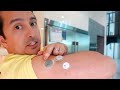 i tested otc vs medical cgms dexcom vs stelo vs libre vs lingo