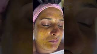 An oxygen facial is a non-medical procedure typically done by an aesthetician to hydrate the skin