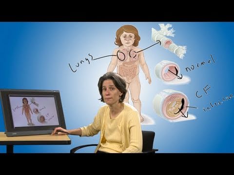 Pediatric Playbook - Cystic Fibrosis Pediatric Playbook - Cystic Fibrosis