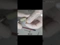 하악 소구치 임시치아 스플린트로 만들기 🦷make the lower small molar temporary tooth splint. 치과위생사 치과 dentalhygiene