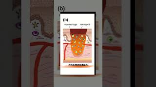 STAGES OF WOUND HEALING. #woundcare #pathology #medical