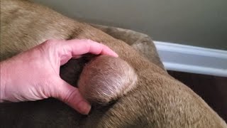 Draining A BIG Cyst by a Nurse Practitioner