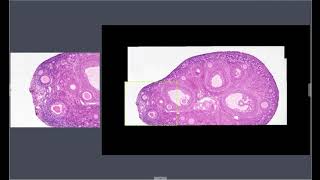 Live Stitching of images, by BioStitch-500 to convert a microscope to a digital sldie scanner