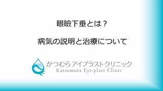 ７０歳以上の３人に１人は眼瞼下垂！「眼瞼下垂とは？　病気の説明と治療について」