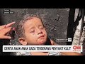 Derita Anak-Anak Gaza Terserang Penyakit Kulit