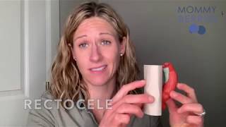 Pelvic Organ Prolapse: Causes, Types, and Treatment