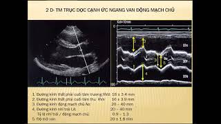 Bài 2a  Siêu âm tim bình thường ở người lớn