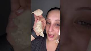 Hero Cosmetics Pimple Patches REMOVING MADNESS!