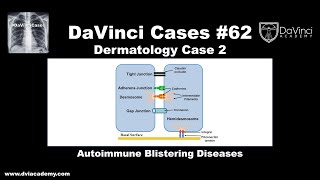 Autoimmune Blistering Diseases [#DaVinciCases Dermatology Case 2]