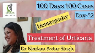 100 DAYS 100 CASES | DAY-52 | URTICARIA CASE CURED SUCCESSFULLY | DR NEELAM AVTAR SINGH | Video 224